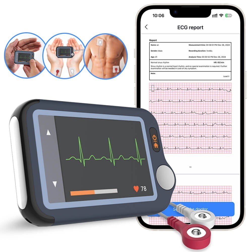 A handheld ECG monitor. CancerCare Manitoba patients will record heart readings at home during the pilot. (File photo)