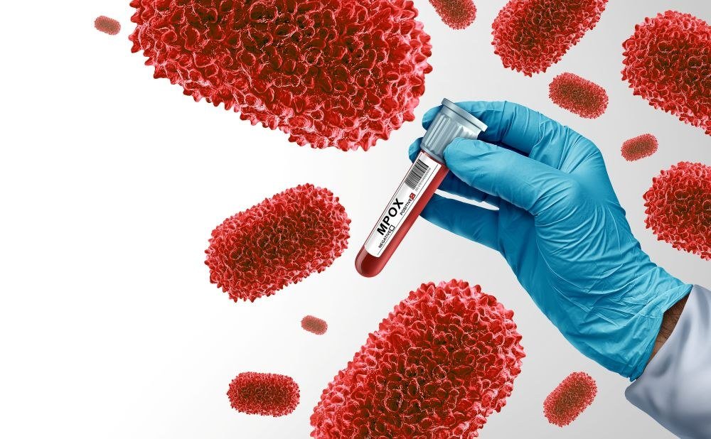 A public health laboratory. South Africa has confirmed 26 mpox cases in 2026.